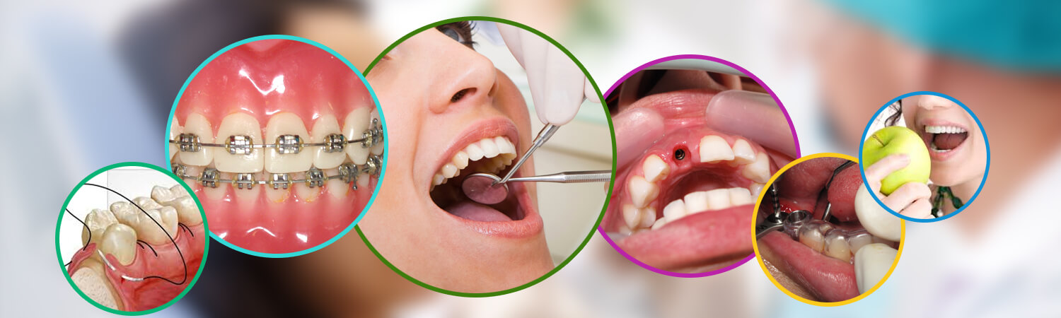 dental care in Bangalore
