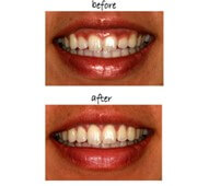 top dental care in koramangala