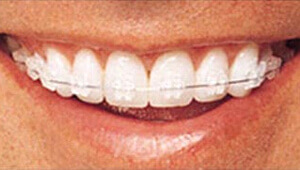 ClearPath Orthodontics
